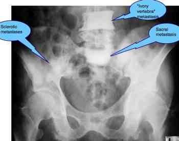 Sacroiliac joint anatomy takes you on a little tour of the pelvis.