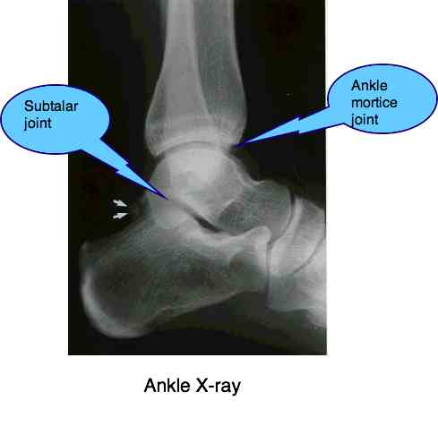 Ankle Joint Pain Case File covers a runner's acute injury.