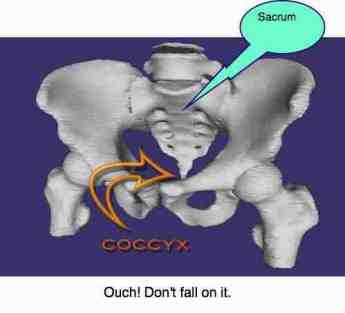 Bruised Coxis
