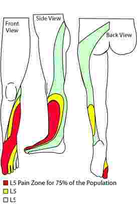 L4 Lumbar Spine is a troublesome area of the low back.