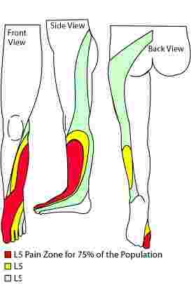Tingling in feet and legs faces the chiropractor on a daily basis.