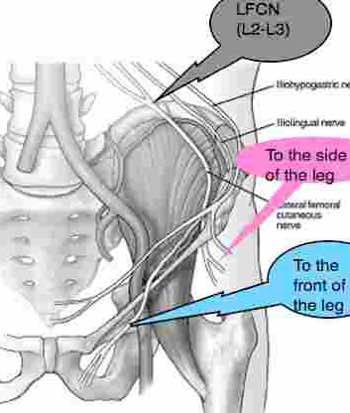 Anterior thigh pain can be very severe especially at night.