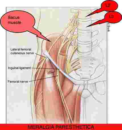 femoral nerve  pain