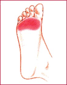 Plantar Fasciitis,Pes Planus,Mallet Toe,High Arched Feet,Heel Spur,Heel Pain,Hammer Toe,Hallux Valgus,Foot Pain,Foot Hard Skin,Foot Conditions,Foot Callous,Flat Feet,Fallen Arches,Diabetic Foot,Contracted Toe,Claw Toe,Bunions Hard Skin,Bunions Callous,Bunion Pain,Ball Of Foot Pain,Back Pain