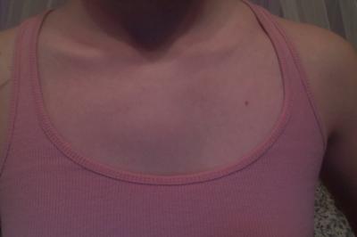 Swollen above left clavicle and tingling left hand