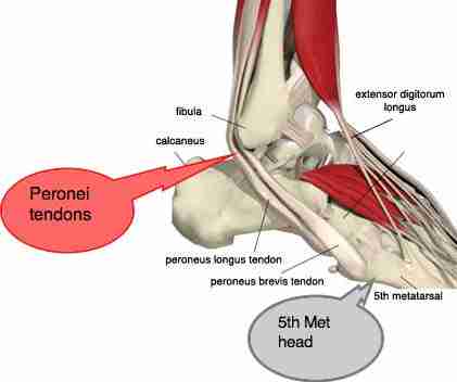 http://www.chiropractic-help.com/images/xAnkle-muscles-lateral.jpg.pagespeed.ic.i9dC3TThWg.jpg