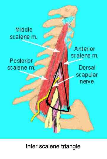 Deep upper back pain can be very difficult to diagnose and manage.