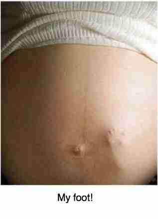 Back butt pain pregnancy
