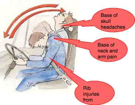 Shock After Car Crash Symptoms Shock After Car Crash Symptoms