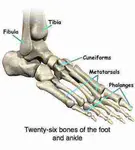 Foot-pain-bones.jpg