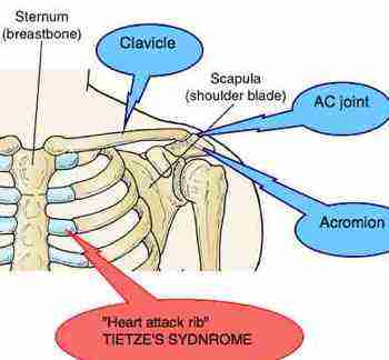 Acromioclavicular joint is key to the frozen shoulder syndromes.
