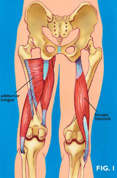 Hip adductor muscles. Hip adductor muscles.