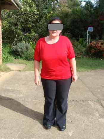 antalgic posture sciatica l5 l4 pisa duizelig chiropractic