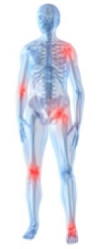 Positions in the skeleton where arthritis can occur. Positions in the skeleton where arthritis can occur.