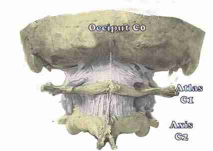 Atlanto occipital joint is a common cause of headaches.
