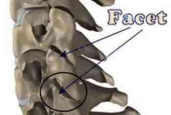 A home traction unit has many benefits for a cervical facet syndrome.