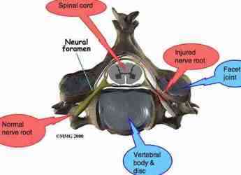 Cervical vertebra axial view Cervical vertebra axial view