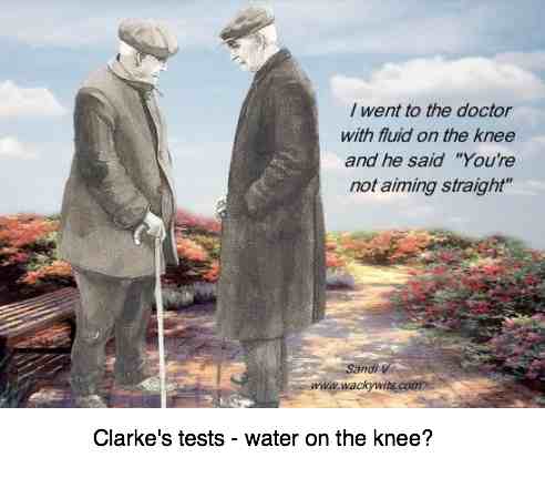 Clarke's test is for fluid and crepitus in the knee.