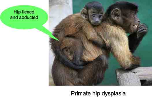 Photograph of a primate carrying an infant with hip position to prevent dysplasia.