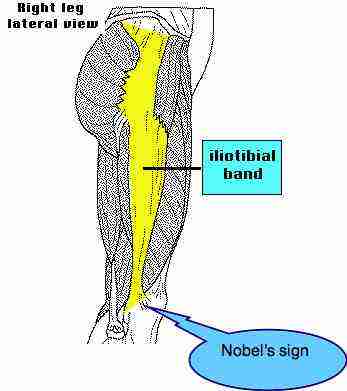 Iliotibial Band Stretch and chiropractic management of the ITB syndrome.