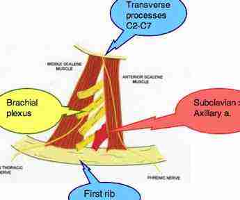Inter-scalene triangle showing artery and nerves. Inter-scalene triangle showing artery and nerves.