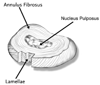 Intervertebral disc. Intervertebral disc.