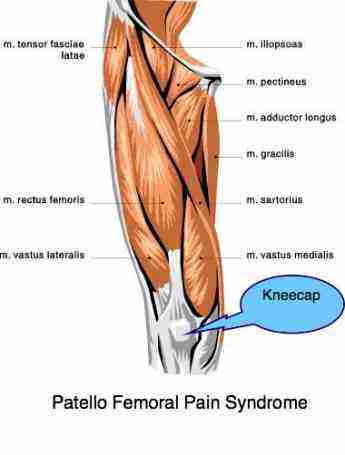 pain above knee cap