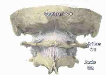 Occiput, atlas and axis subluxations are common causes of neck pain and headache. Occiput, atlas and axis subluxations are common causes of neck pain and headache.