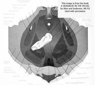 Self massage of the pubococcygeus muscles using the finger is not really recommended. Self massage of the pubococcygeus muscles using the finger is not really recommended.
