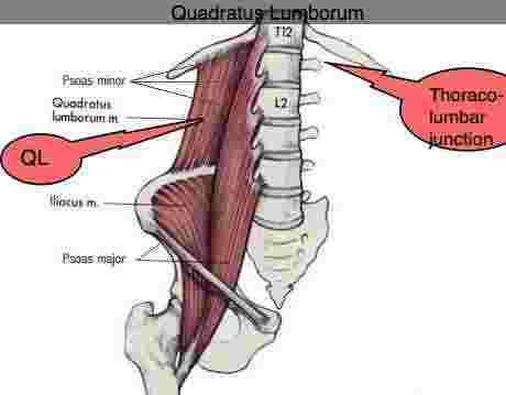 QL muscles are important in Maigne's syndrome exercises.