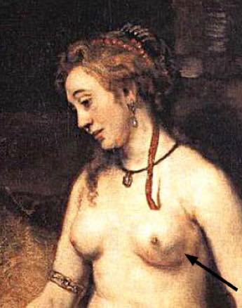 Rembrandt's wife with breast cancer.