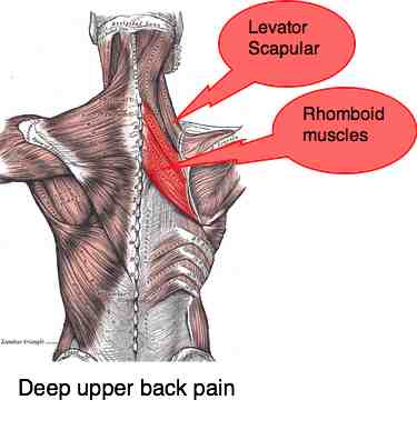 Deep upper back pain can be very difficult to diagnose and manage.