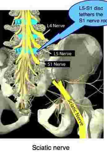 Sciatic Nerve in Leg Diagram