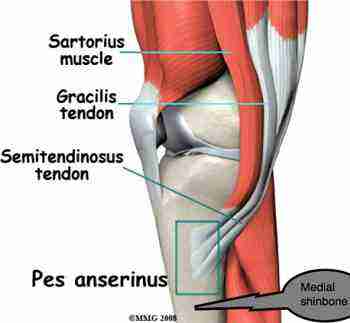 Shin splints affects the semitendinosis muscle. Shin splints affects the semitendinosis muscle.