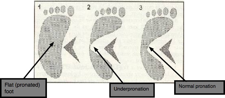 The wet test for shin splints. The wet test for shin splints.