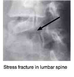 How reliable are x-rays? They are only as trustworthy as the reporter.