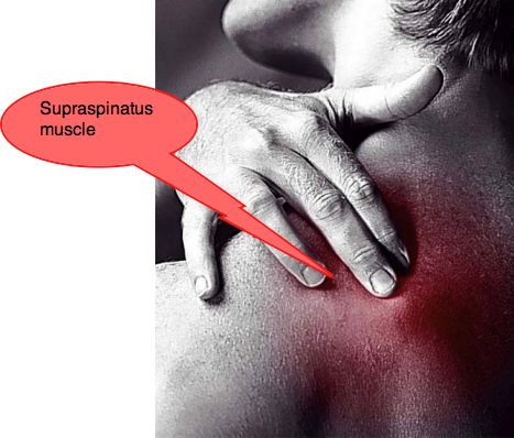 Supraspinatus muscle. Supraspinatus muscle.
