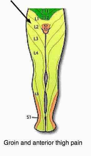 Upper leg and groin pain dermatomes. Upper leg and groin pain dermatomes.