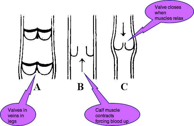 Varicose veins in legs Varicose veins in legs