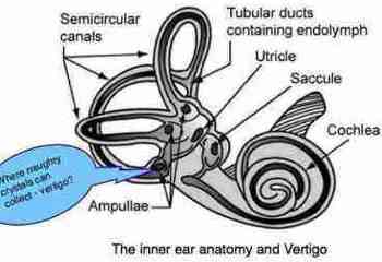 Vertigo dizziness can turn you upside down but there is a DC solution
