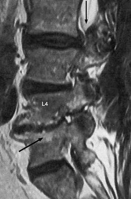 Does your back look like this, but with the BMP?