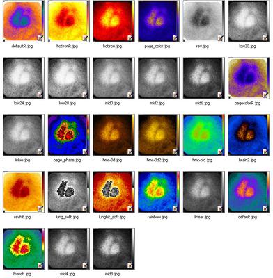 MRI images of my head