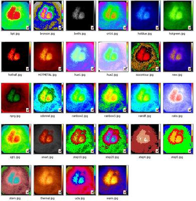 MRI images of my head 2