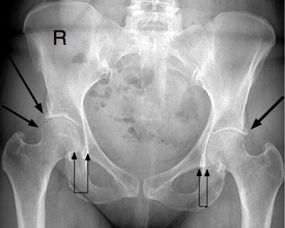 Have you had any x-rays taken recently?