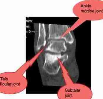 X-ray of joints in the ankle