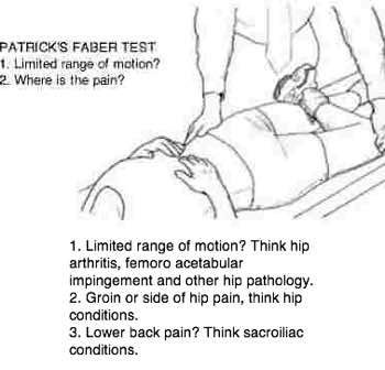 Lower back and right groin pain. Trapped femoral nerve?