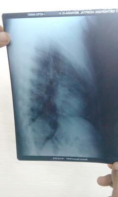 x ray 