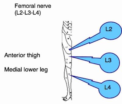 Meralgia paresthetica or femoral nerve?