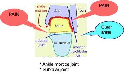 Diagram of ankle anatomy