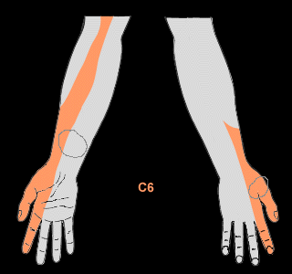 areas where I feel discomfort the most